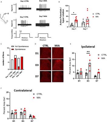 Role of Primary Afferents in Arthritis Induced Spinal Microglial Reactivity